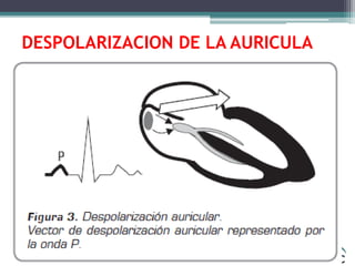 RACC
DESPOLARIZACION DE LA AURICULA
 