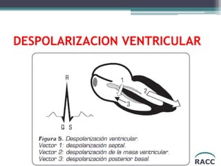 RACC
DESPOLARIZACION VENTRICULAR
 