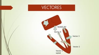 VECTORES
Vector 1
septal
Vector 2
Vector 4
Vector 3
NODO AV
 