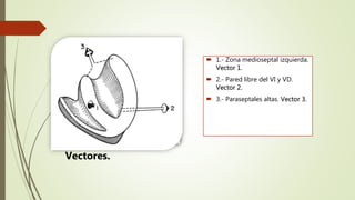  1.- Zona medioseptal izquierda.
Vector 1.
 2.- Pared libre del VI y VD.
Vector 2.
 3.- Paraseptales altas. Vector 3.
Vectores.
 