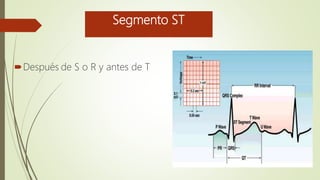 Segmento ST
Después de S o R y antes de T
 