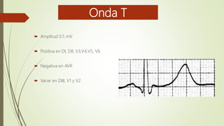 Onda T
 Amplitud 0.5 mV
 Positiva en DI, DII, V3,V4,V5, V6
 Negativa en AVR
 Variar en DIII, V1 y V2
 