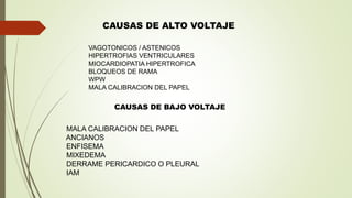 VAGOTONICOS / ASTENICOS
HIPERTROFIAS VENTRICULARES
MIOCARDIOPATIA HIPERTROFICA
BLOQUEOS DE RAMA
WPW
MALA CALIBRACION DEL PAPEL
CAUSAS DE ALTO VOLTAJE
MALA CALIBRACION DEL PAPEL
ANCIANOS
ENFISEMA
MIXEDEMA
DERRAME PERICARDICO O PLEURAL
IAM
CAUSAS DE BAJO VOLTAJE
 