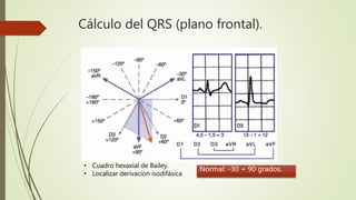 Cálculo del QRS (plano frontal).
• Cuadro hexaxial de Bailey.
• Localizar derivación isodifásica
Normal: -30 + 90 grados.
 