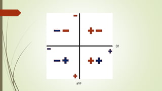 D1
aVF
 