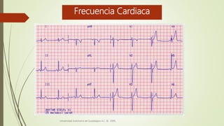 Frecuencia Cardiaca
Universidad Autónoma de Guadalajara A.C. © 2009.
 