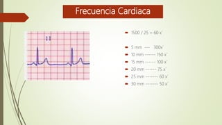 Frecuencia Cardiaca
27 mm
 1500 / 25 = 60 x´
 5 mm --- 300x´
 10 mm ------ 150 x´
 15 mm ------ 100 x´
 20 mm ------ 75 x´
 25 mm ------- 60 x´
 30 mm ------- 50 x´
 