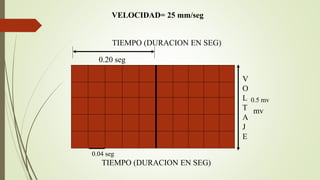 0.20 seg
0.04 seg
V
O
L
T
A
J
E
TIEMPO (DURACION EN SEG)
0.5 mv
mv
TIEMPO (DURACION EN SEG)
VELOCIDAD= 25 mm/seg
 