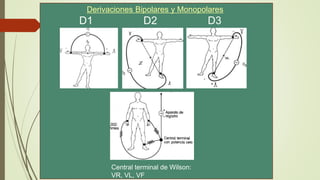 Central terminal de Wilson:
VR, VL, VF
D1 D2 D3
Derivaciones Bipolares y Monopolares
 