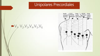 Unipolares Precordiales
V1, V2,V3,V4,V5,V6
 