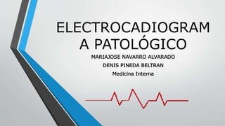ELECTROCADIOGRAM
A PATOLÓGICO
MARIAJOSE NAVARRO ALVARADO
DENIS PINEDA BELTRAN
Medicina Interna
 