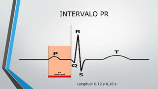 INTERVALO PR
Longitud: 0,12 y 0,20 s
 