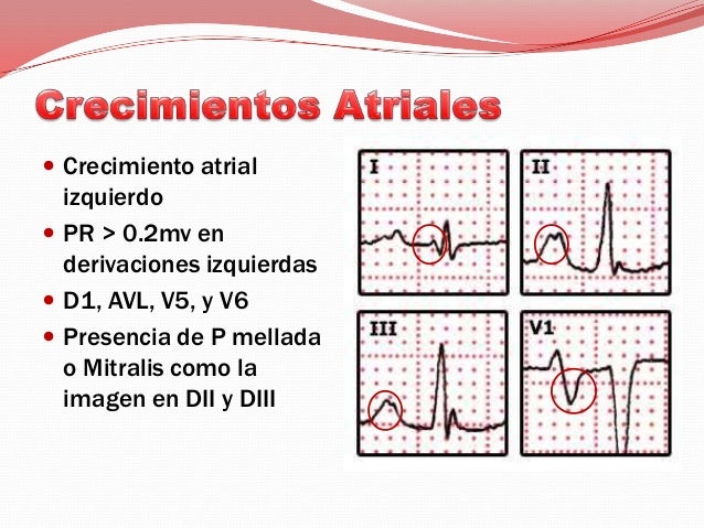 EKG basico