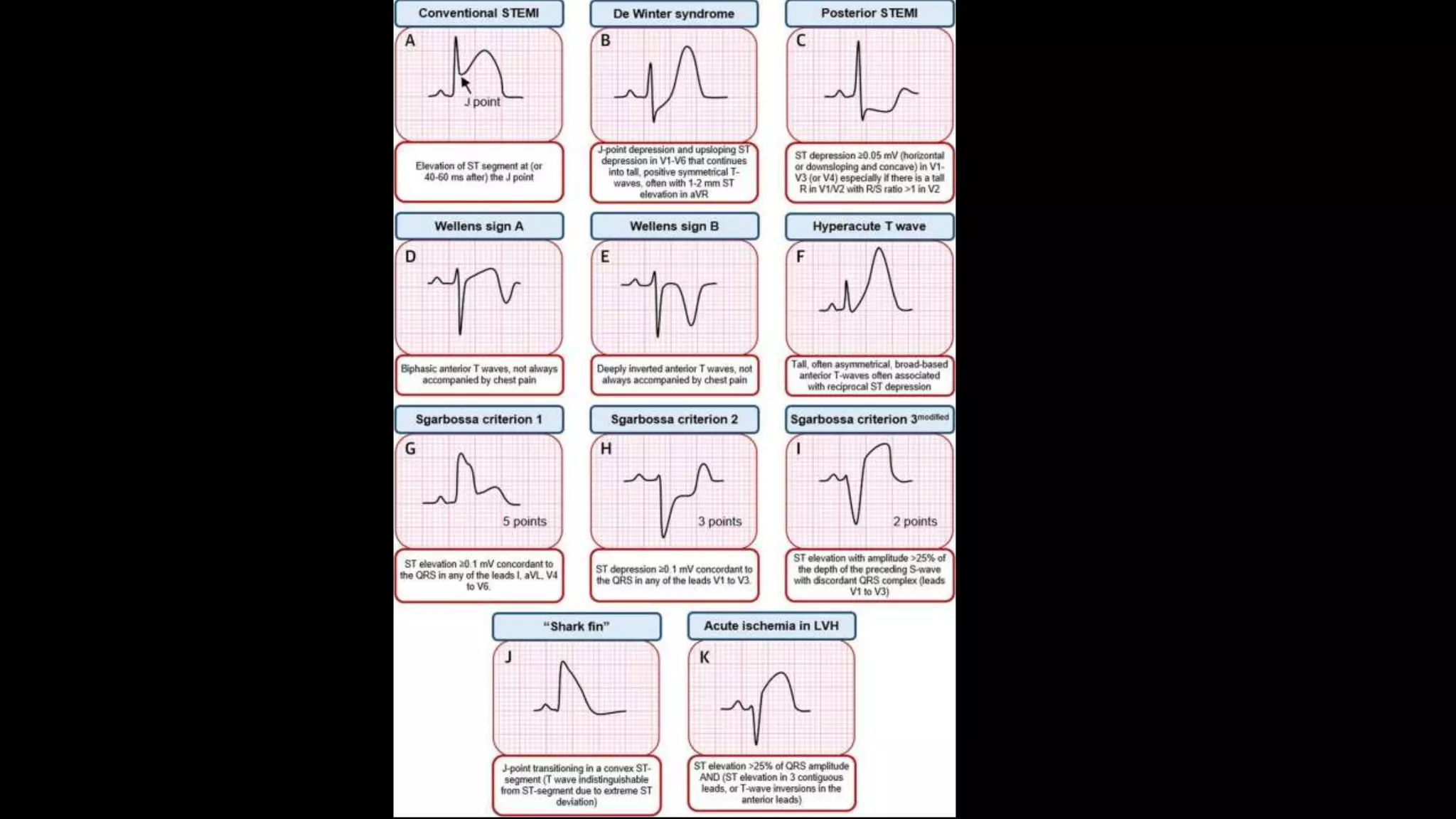 EKG part 1.pptx