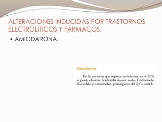 ALTERACIONES INDUCIDAS POR TRASTORNOS
ELECTROLITICOS Y FARMACOS.
 AMIODARONA.
 