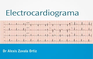 Electrocardiograma
Dr Alexis Zavala Ortiz
 