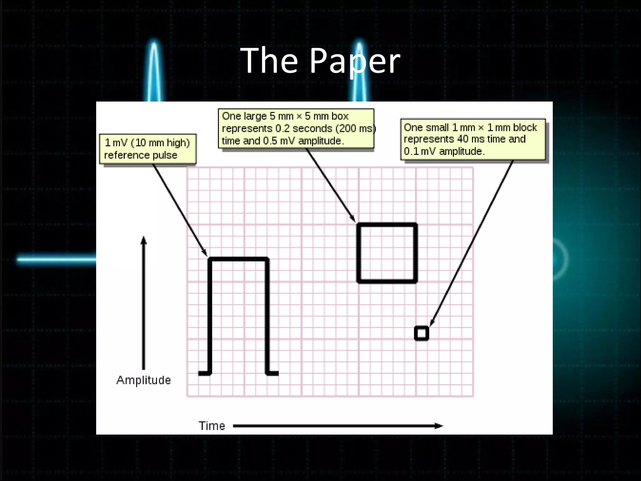 Ekg Powerpoint Ppt