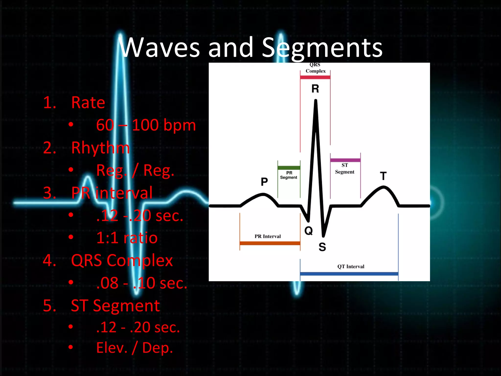 Ekg powerpoint | PPT