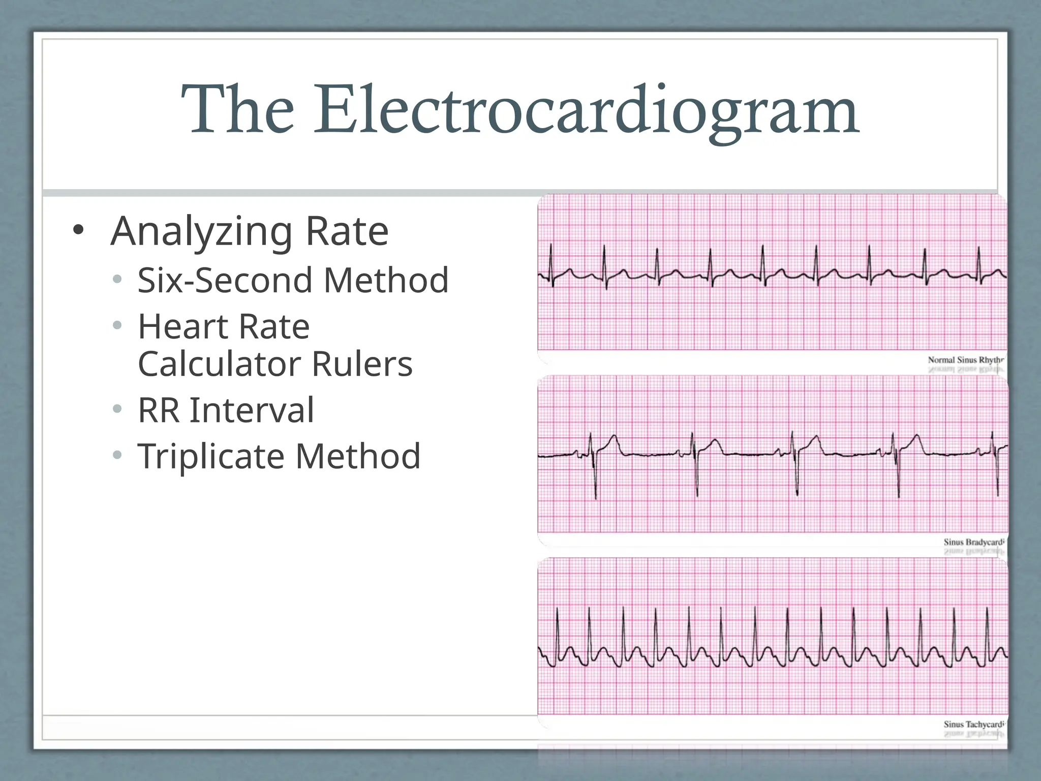 The Electrocardiogram
• Analyzing Rate
• Six-Second Method
• Heart Rate
Calculator Rulers
• RR Interval
• Triplicate Method
 
