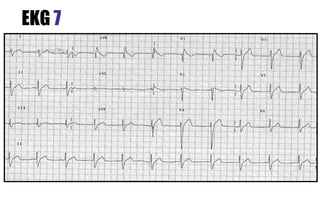 EKG 7
 