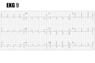EKG 9
 