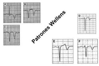 n s
                         l le
                        e
                    W
              e s
           o n
    a tr
P
 