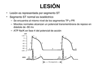 LESIÓN
• Lesión es representada por segmento ST
• Segmento ST normal es isoeléctrico
   – Se encuentra al mismo nivel de los segmentos TP y PR
   – Miocitos normales alcanzan un potencial transmembrana de reposo en
     diástole de -90 mv
   – ATP Na/K en fase 4 del potencial de acción
 
