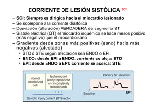 CORRIENTE DE LESIÓN SISTÓLICA SCI
–   SCI: Siempre es dirigida hacia el miocardio lesionado
–   Se sobrepone a la corriente diastólica
–   Desviación (alteración) VERDADERA del segmento ST
–   Sístole eléctrica (QT) el miocardio isquémico se hace menos positivo
    (más negativo) que el miocardio sano
– Gradiente desde zonas más positivas (sano) hacia más
  negativas (afectado)
     • STD ó STE según afectación sea ENDO o EPI
     • ENDO: desde EPI a ENDO, corriente se aleja: STD
     • EPI: desde ENDO a EPI: corriente se acerca: STE




                                                             EPI
 