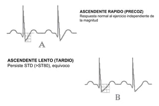 ASCENDENTE RAPIDO (PRECOZ)
                                 Respuesta normal al ejercicio independiente de
                                 la magnitud




ASCENDENTE LENTO (TARDIO)
Persiste STD (>ST80), equivoco
 
