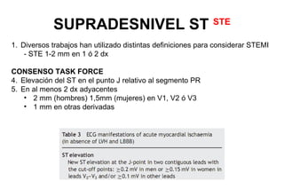 SUPRADESNIVEL ST                                 STE

1. Diversos trabajos han utilizado distintas definiciones para considerar STEMI
    - STE 1-2 mm en 1 ó 2 dx

CONSENSO TASK FORCE
4. Elevación del ST en el punto J relativo al segmento PR
5. En al menos 2 dx adyacentes
    • 2 mm (hombres) 1,5mm (mujeres) en V1, V2 ó V3
    • 1 mm en otras derivadas
 