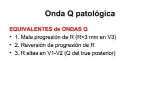 Onda Q patológica
EQUIVALENTES de ONDAS Q
• 1. Mala progresión de R (R<3 mm en V3)
• 2. Reversión de progresión de R
• 3. R altas en V1-V2 (Q del true posterior)
 