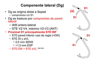 Componente lateral (Dg)
                                                       D1
• Dg se origina distal a Septal                 (a)
   – compromiso c/s S1
• Dg se traduce por compromiso de pared           S1
  lateral
   – IAM antero-lateral
   – STE V2-V4, máximo V2-V3 (ANT)
• Proximal D1 principalmente STD INF
   – STD pared inferior casi de regla (>DIII)           D1
   – STE DI y aVL
      • 0,5 mm SENS
      • >1,0 mm ESP                              S1
   – STD DIII > STE aVL S85 E95
 