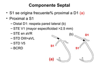 Componente Septal
• S1 se origina frecuente% proximal a D1 (a)
• Proximal a S1
  – Distal D1: respeta pared lateral (b)
  – STE V1 (mayor especificidad >2.5 mm)
  – STE en aVR                           (b)      D1
  – STD DIII>aVL
  – STD V5
                            S1
  – BCRD                                     S1


                           (a)
 