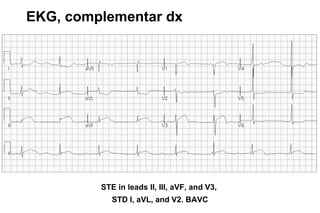 EKG, complementar dx




         STE in leads II, III, aVF, and V3,
            STD I, aVL, and V2. BAVC
 