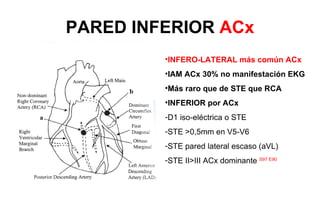 PARED INFERIOR ACx
         •INFERO-LATERAL más común ACx
         •IAM ACx 30% no manifestación EKG
         •Más raro que de STE que RCA
         •INFERIOR por ACx
         -D1 iso-eléctrica o STE
         -STE >0,5mm en V5-V6
         -STE pared lateral escaso (aVL)
         -STE II>III ACx dominante S97 E90
 