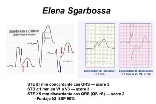 Elena Sgarbossa




STE ≥1 mm concordante con QRS — score 5.
STD ≥ 1 mm en V1 a V3 — score 3.
STE ≥ 5 mm discordante con QRS (QS, rS) — score 2
   - Puntaje ≥3 ESP 90%
 