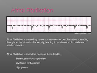 Atrial fibrillation is caused by numerous wavelets of depolarization spreading
throughout the atria simultaneously, leading to an absence of coordinated
atrial contraction.
Atrial fibrillation is important because it can lead to:
Hemodynamic compromise
Systemic embolization
Symptoms
www.uptodate.com
 