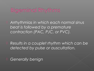  Arrhythmias in which each normal sinus
beat is followed by a premature
contraction (PAC, PJC, or PVC).
 Results in a couplet rhythm which can be
detected by pulse or auscultation.
 Generally benign
 
