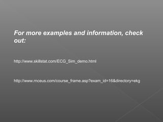 For more examples and information, check
out:
http://www.skillstat.com/ECG_Sim_demo.html
http://www.rnceus.com/course_frame.asp?exam_id=16&directory=ekg
 