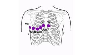 ELECTROCARDIOGRAMA RITMO SINUSAL 2..pptx