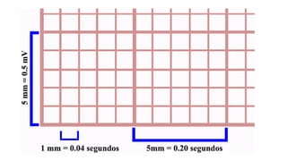 ELECTROCARDIOGRAMA RITMO SINUSAL 2..pptx