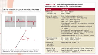 LEFT VENTRICULAR HYPERTROPHY
 