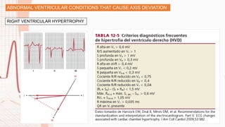 RIGHT VENTRICULAR HYPERTROPHY
ABNORMAL VENTRICULAR CONDITIONS THAT CAUSE AXIS DEVIATION
 