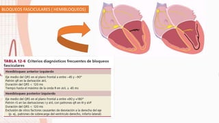 BLOQUEOS FASCICULARES ( HEMIBLOQUEOS)
 
