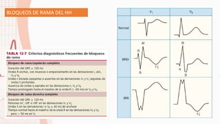 BLOQUEOS DE RAMA DEL HH
 