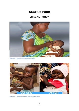 28
SECTION FOUR
CHILD NUTRITION
Picture 6: A woman breastfeeding her baby
Picture 7: A malnourished and well-nourished chi...