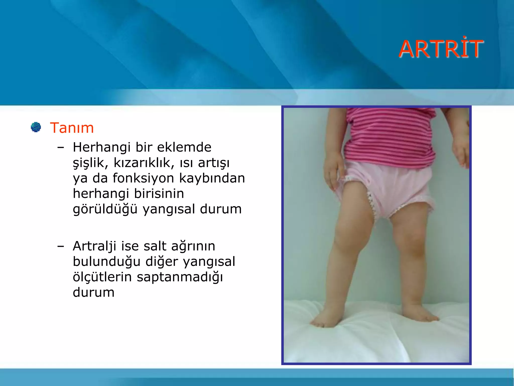 ARTRĠT


Tanım
– Herhangi bir eklemde
  ĢiĢlik, kızarıklık, ısı artıĢı
  ya da fonksiyon kaybından
  herhangi birisinin
  görüldüğü yangısal durum

– Artralji ise salt ağrının
  bulunduğu diğer yangısal
  ölçütlerin saptanmadığı
  durum
 