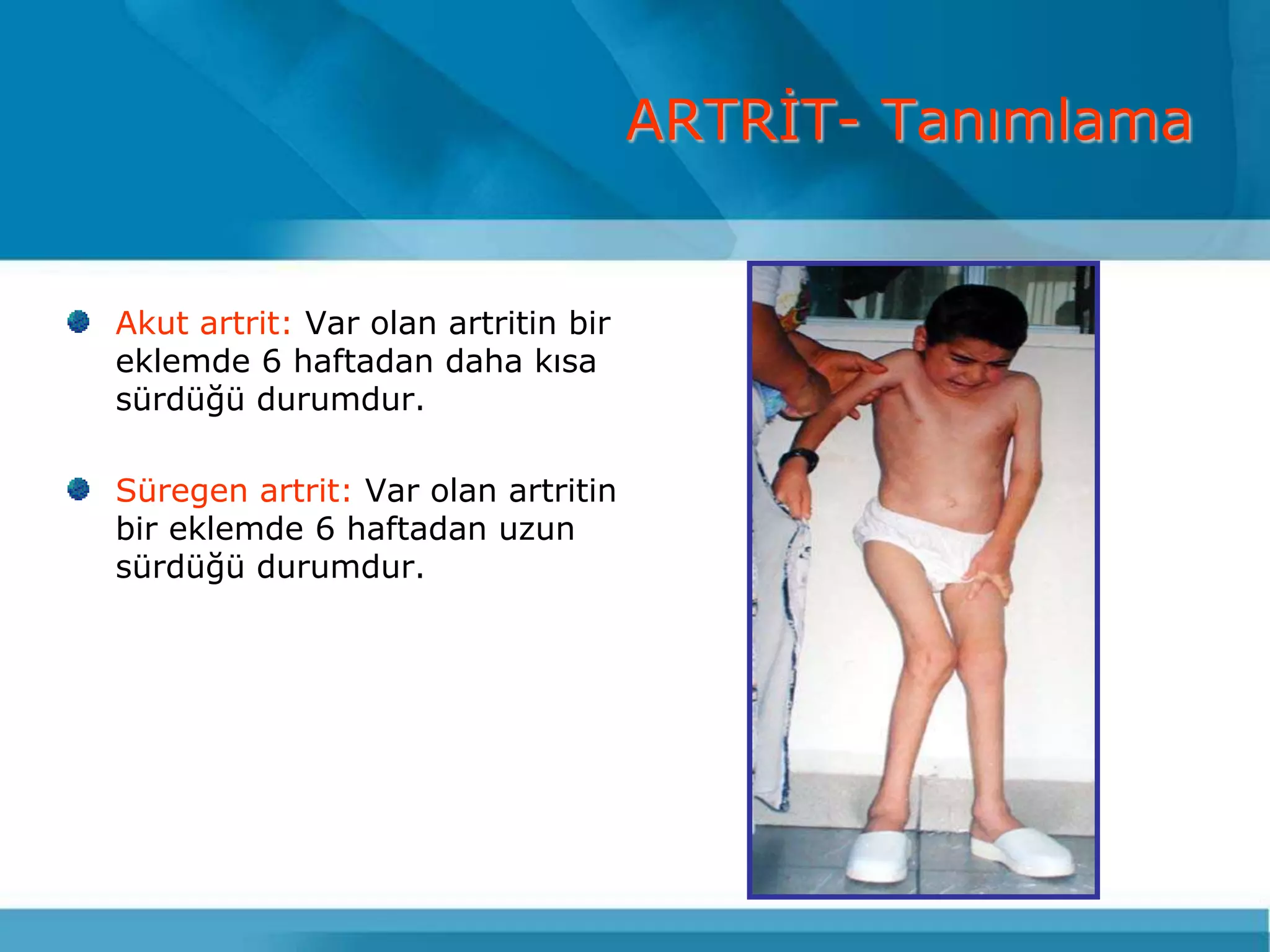 ARTRĠT- Tanımlama


Akut artrit: Var olan artritin bir
eklemde 6 haftadan daha kısa
sürdüğü durumdur.

Süregen artrit: Var olan artritin
bir eklemde 6 haftadan uzun
sürdüğü durumdur.
 