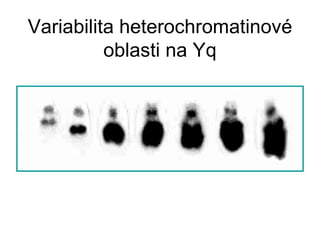 Variabilita heterochromatinové oblasti na Yq 