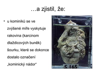 …a zjistil, že: u kominíků se ve zvýšené míře vyskytuje rakovina (karcinom dlaždicových buněk) šourku, které se dokonce dostalo označení „kominický nádor“ 